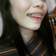 A dm ternyata hanya kau harus aku cintai. Girlbraces Instagram Posts Photos And Videos Picuki Com