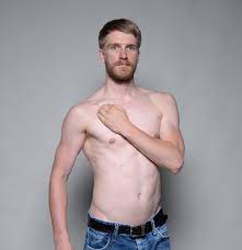 This makes it an allround massage technique. Subclavius Muscle Pain Trigger Points
