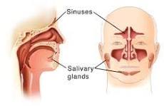 Image result for paranasal tumor treatment what does it feel like