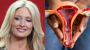 Celebrity matchmaker Amber Kelleher-Andrews dies after cancer battle: What  is Ovarian Cancer and what are the early signs?