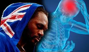 Audley Harrison health: British boxing champion has brain damage from years  of fighting
