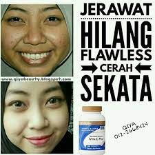 ₹ 480/ vial get latest price. Bahaya Suntikan Vitamin C Qiya Beauty