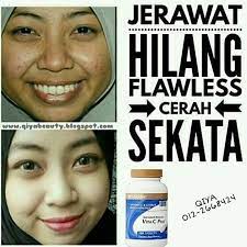 Suntikan yang terlalu cepat juga biasanya menimbulkan rasa pusing dan ada sensasi seperti mau pingsan. Bahaya Suntikan Vitamin C Qiya Beauty