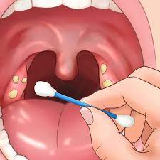Maybe you would like to learn more about one of these? 11 Tips For Removing Tonsil Stones That Ll Make You Sigh With Relief