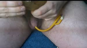 Permanent Catheter - ThisVid.com
