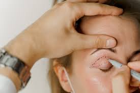 Blefaroplastia Tudo Sobre A Cirurgia Das Palpebras Dr Leandro Pellarin