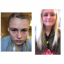 Quick update for all my wonderful humans. Today is round 3, cycle 11, day  50!!!!! Treatment is going well. Just always exhausted. Blood work has been  okay. Red blood cells 3.57. White