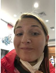 Prospective missionary shares what it's like to get all their wisdom teeth  pulled out