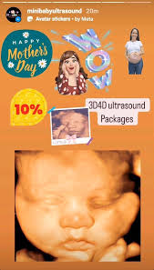 All this Month !!!, MOTHER'S DAY ULTRASOUND SPECIAL OFFER, 3D4D ULTRASOUND  PACKAGES ONLY, 10 % OFF , More details can call 📲 786-532-7525 , Todo este  mes de Mayo !!!!, OFERTA ESPECIAL POR EL DIA DE ...