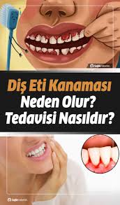 Dis Eti Kanamasi Neden Olur Tedavisi Nasildir Dis Dogal Saglik Saglikli Yasam