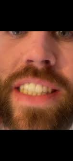 Hello I'm new to the area and want to restart my Aesthetics business in  Thetford I offer a wide range of treatments which I'm currently offering  for a hugely discounted price until