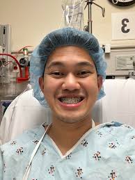 Dag 0 till dag 3 efter operation. Jag genomgick käkkirurgi (DJS) för att  korrigera min klass 3-underbett med Dr. Williams här på Kaiser Oakland. :  r/jawsurgery