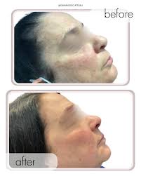 Dermatology Associates Of NJ (@dermassociatesnj) · Instagram 照片和视频