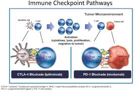 Aprende sobre los síntomas, las causas y el tratamiento de esta grave infección pulmonar. Esmo19 CombinaÈia Nivolumab Èi Ipilimumab CreÈte SupravieÈuirea GlobalÄ In Prima Linie De Tratament A Cancerului Pulmonar Non Microcelular Raportul De GardÄ