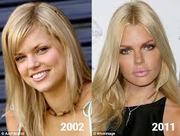 Gets dissed by a listener! Sophie Monk S Physical Transformation Dr Haworth