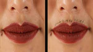 Electrolysis is a method of permanently removing individual hairs from the face or body, according to dr. Women Grow Out Their Facial Hair For 30 Days Youtube