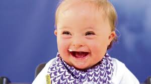 Cork baby who has Down Syndrome wins modelling contract with Glenisk's  Organic No-Added-Sugar Baby Yogurts