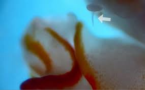 Kết quả hình ảnh cho sên biển