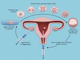 Ved eggløsningen frigjøres ett av eggene. Assistert Befruktning Bioteknologiradet