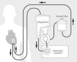 Oxygenator is non profit campiagn, focussed on planting trees and create. 02 Continuously Innovating First In Class Technology To Support Cardiovascular Surgery Stories Our Technologies Technology Terumo Global