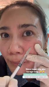 My DIY SkinMDC NCTF treatment moment! 😅I’m in my 40ish so this is one of  my much needed treatment to have a healthy and glowing skin. Benefits of  SkinMDC NCTF treatment are: hydrates, brightens, and ...