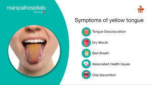 Image result for yellow tongue infection