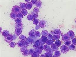 Image result for mastocytoma in dogs