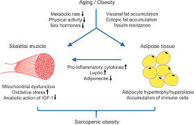 'a new name, sarcopenia or vanishing flesh has been applied to maude's illness.' 'advancing age brings progressive loss of muscle strength, muscle mass, and muscle quality, resulting in a condition known as sarcopenia.' 'preventing sarcopenia, as well as minimizing bone loss, can improve the health of postmenopausal women.' Frontiers Health Consequences Of Sarcopenic Obesity A Narrative Review Endocrinology