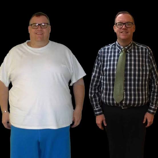 Mini Gastric Bypass In Dubai Abu Dhabi - Best Mini Gastric Bypass Surgeon  Dubai Abu Dhabi