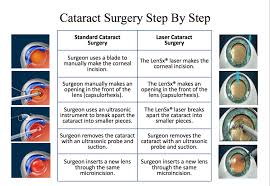 Image result for Cataract Extraction
