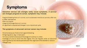The symptoms of cervical cancer. Topics To Be Discussed Symptoms Causes What Is Cervical Cancer Treatment Detection Hpv Vaccination Ppt Download