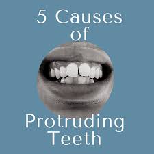 We did not find results for: 5 Causes Of Protruding Teeth Kids Dental Specialists