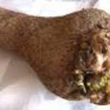 Image result for Dioscorea dregeana