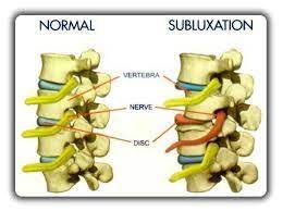 We did not find results for: Pinched Nerve In Neck Pain Relief Chamberlain Chiropractic Wellness Of West Chester Pa