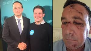 If taoiseach saw my injuries, Fine Gael wouldn't pick John McGahon' :  r/ireland