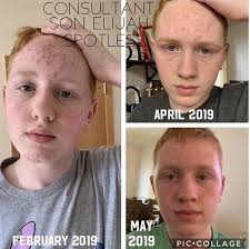 Pin On Rodan And Fields