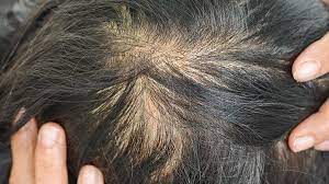 Causes of dry hair a variety of factors can lead to dry hair, including environmental conditions, hair care habits, and your physical health. 7 Things Your Hair Reveals About Your Health Everyday Health