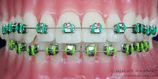 Pin On Brackets