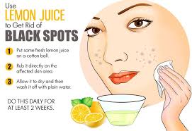 Home remedies are the most economic and effective way to treat dark spots. Pin By Amazing Health Tips On Self Care Dark Spots On Skin Skin Spots Dark Spots On Face