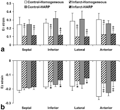 How did i get roof rats? Harmonic Phase Mr Tagging For Direct Quantification Of Lagrangian Strain In Rat Hearts After Myocardial Infarction Liu 2004 Magnetic Resonance In Medicine Wiley Online Library