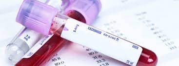 Maybe you would like to learn more about one of these? Exames De Sangue Devem Ser Sempre Colhidos Em Jejum Laboratorio Julio Vargas