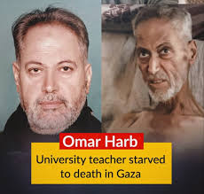 Dr. Omar Harb, a university professor, died today of acute malnutrition and  starvation. His wife, most of his children, and 7 of his grandchildren,  were all kiII3d in an I$reeeIi massacre against