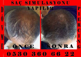 Tattoo Beykoz Sac Simulasyonu Pigmentasyon Nedir Sac Tattoo Piercing