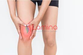 Lutut mungkin terlihat bengkak karena cedera pada tendon, ligamen atau meniskus. Obat Lutut Bengkak Archives Klinik Patella
