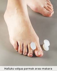 Maalesef sahip olduğum ayak çeşididir.üstüne üstlük baş parmağı çıkıntısı denilen kemiğim de var. Halluks Valgus Nedir Nasil Tedavi Edilir Prof Dr Levent Altinel Antalya Ortopedi Doktoru Meniskus On Capraz Bag Diz Protezi Kalca Protezi Ortopedi Ve Travmatoloji Ortopedi Uzmani Ortopedi Cerrahisi Kireclenme Omuz