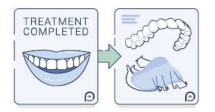 How to clean retainers by type. All You Need To Know About Orthodontic Retainers Braces Vs Retainers