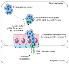 Ovarian cancer is the uncontrolled growth of abnormal cells in the ovaries. Ijms Free Full Text Therapeutic Targeting Of Collective Invasion In Ovarian Cancer Html
