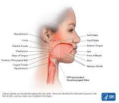Head And Neck Cancers | Cdc