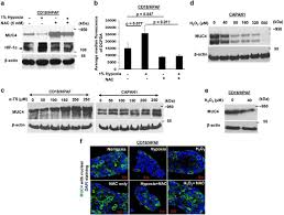Here you will find the current foreign exchange rates for converting 20000 euro (eur) in romanian leu (ron) today. Hypoxia Induced Oxidative Stress Promotes Muc4 Degradation Via Autophagy To Enhance Pancreatic Cancer Cells Survival Oncogene