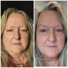 How are your eyes working this morning?